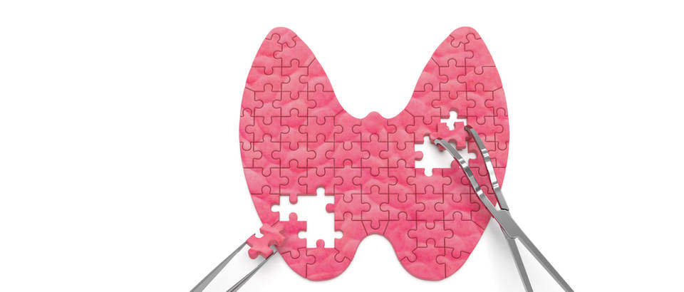 Rezultat slika za štitnjača