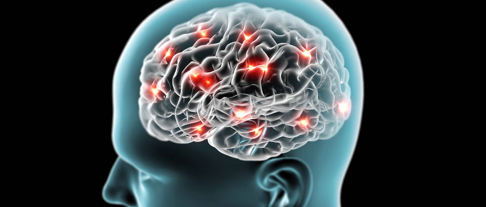 mozdani udar,Shutterstock 159823838
