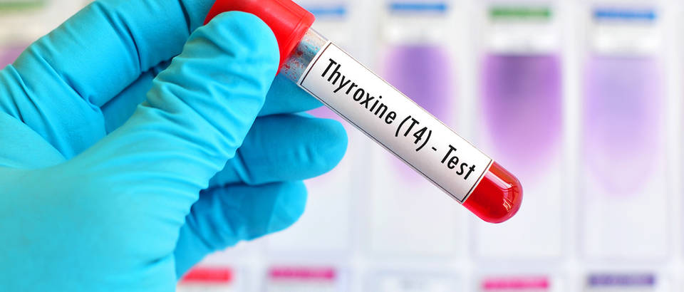 Stitnjaca, krvne pretrage za stitnjacu