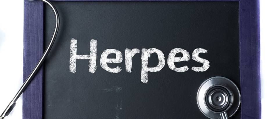 Herpes