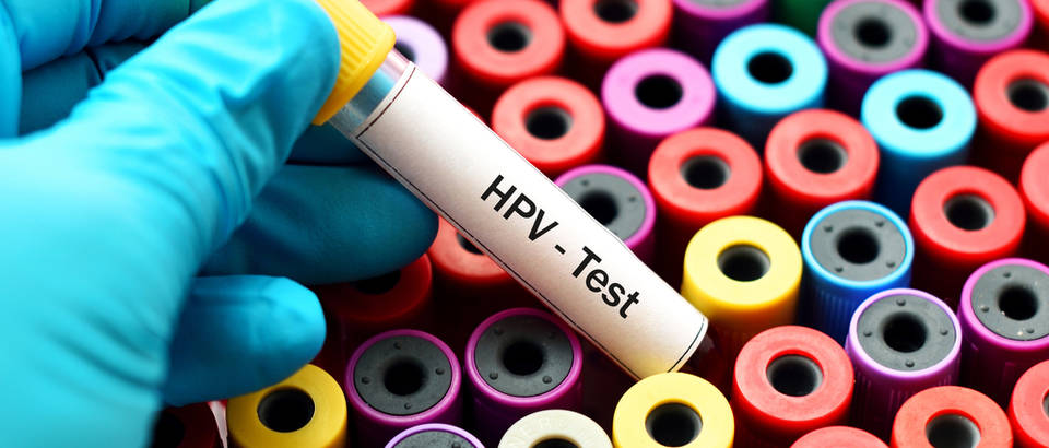 Hpv test
