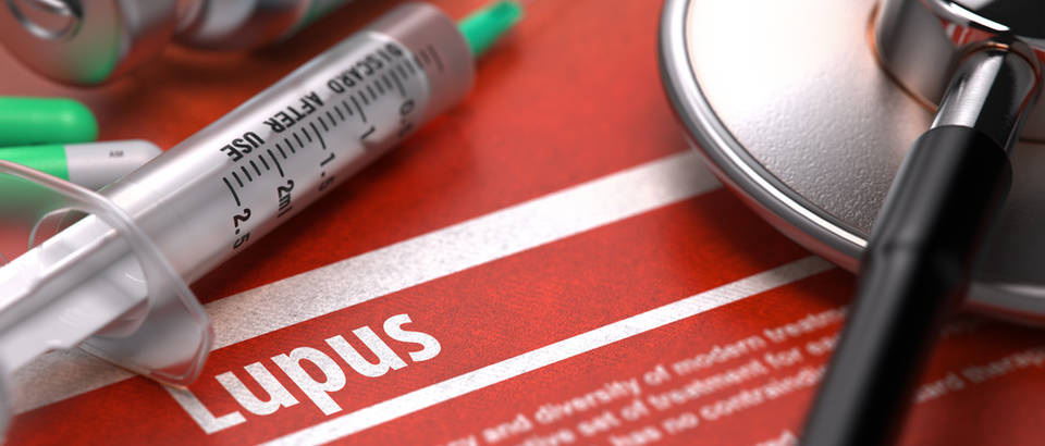 Lupus shutterstock