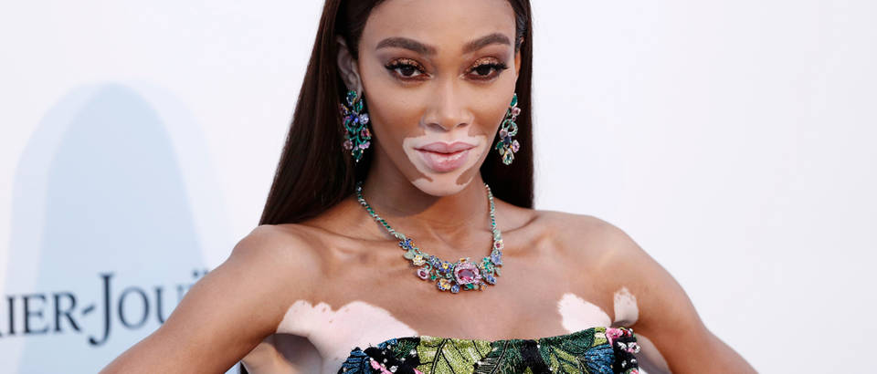 Winnie Harlow Shutterstock 1437899090