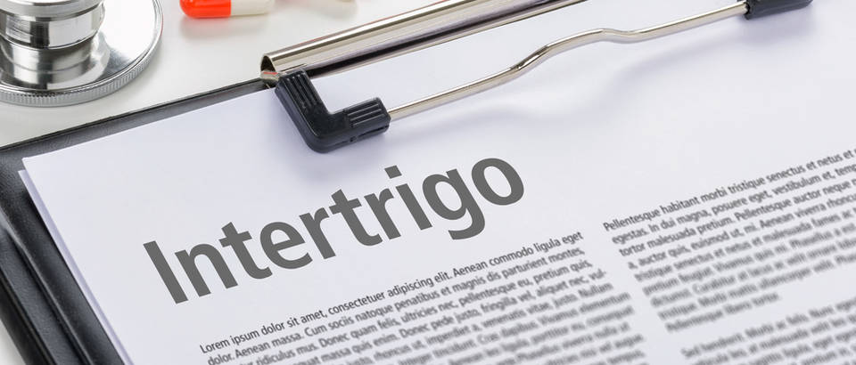 intertrigo, Shutterstock 431719603