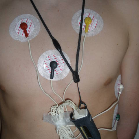 24-satni holter EKG