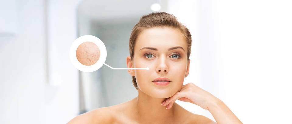 lice, suha koza, Shutterstock 152011343
