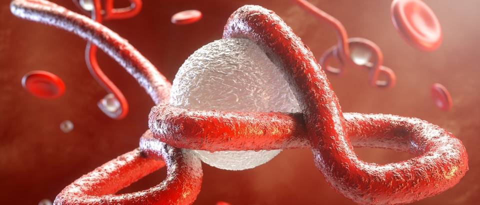 ebola shutterstock