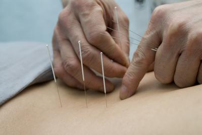 pomaže li akupunktura kod bolova u zglobovima