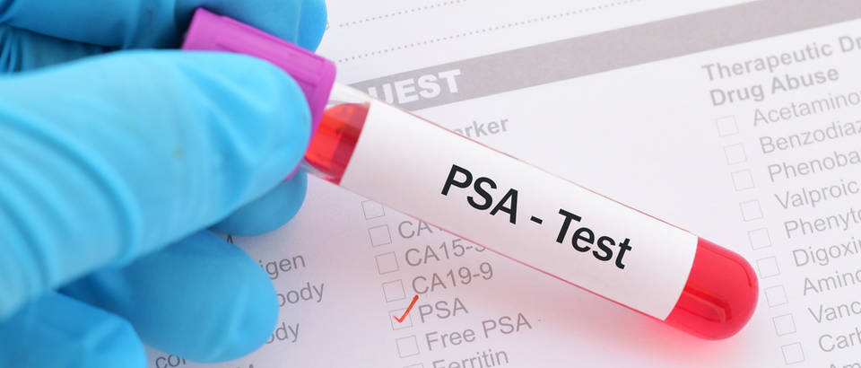 PSA, prostata Shutterstock 725497024