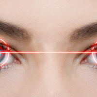 laser, oci, Shutterstock 140368687