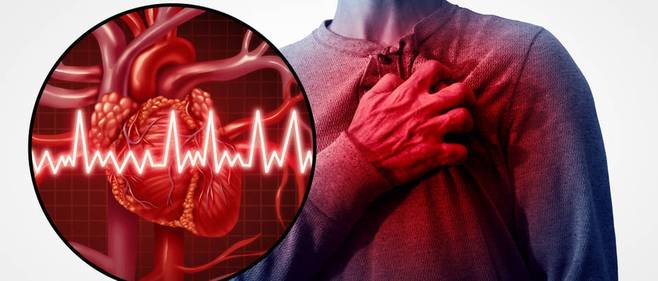 krvni pritisak kod infarkta