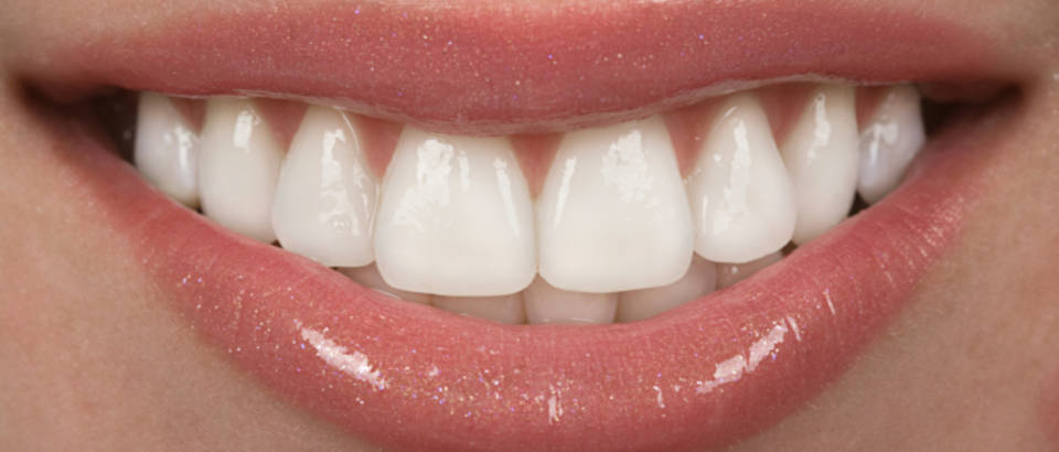 zubi-osmijeh-usne-zubar