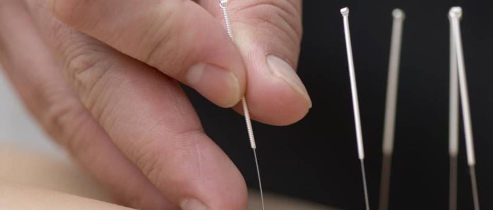 liječenje artritisa akupunktura zašto s bolovima u zglobovima s gripom