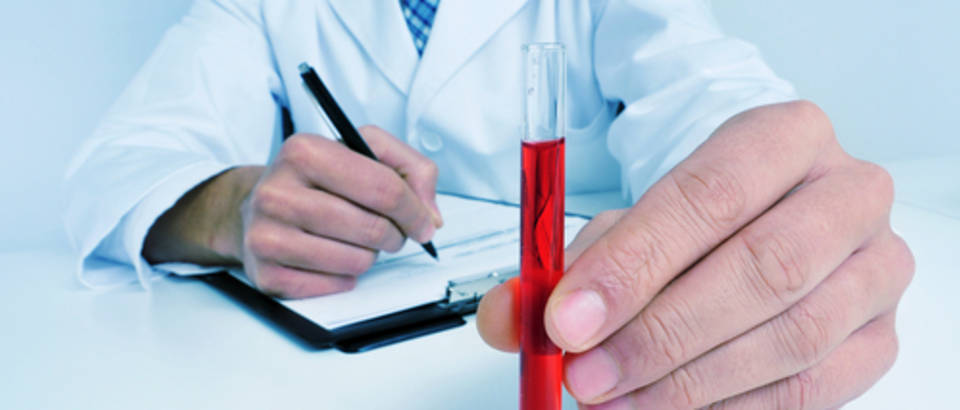 krvna slika, laboratorij shutterstock
