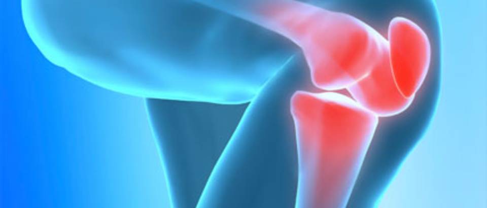 bol u koljenu joint sportu liječenje osteoartritisa diluch