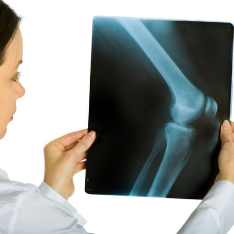 Metode za prevenciju artroze koljena - Masaža - 
