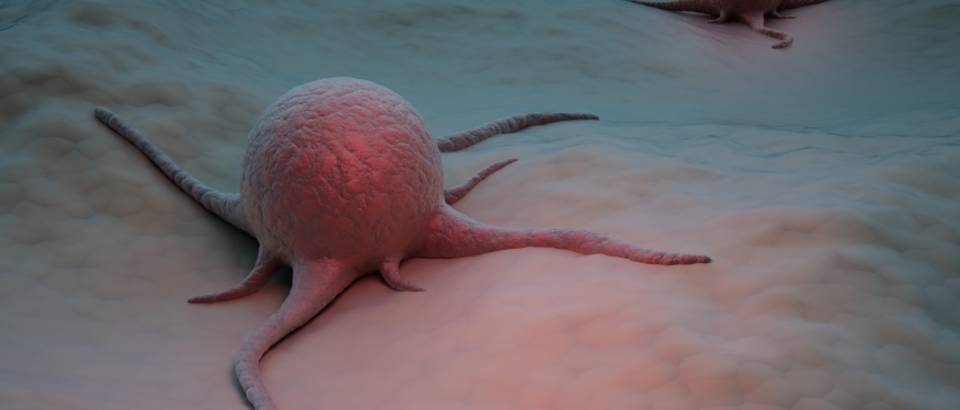 tumor-rak-stanica-3