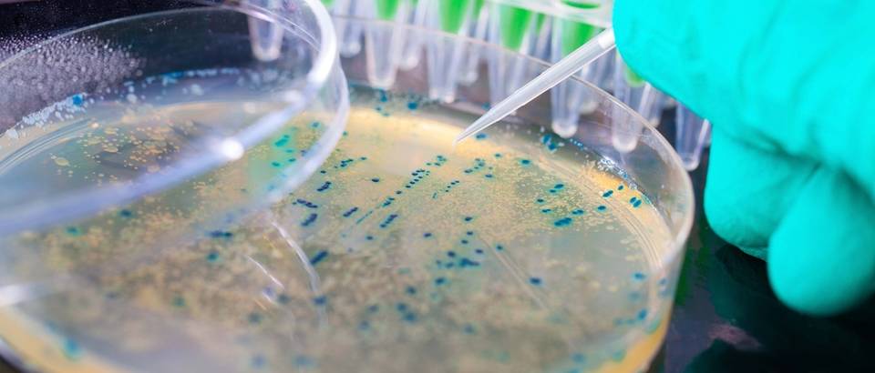 e. coli, bakterije, laboratorij, shutterstock