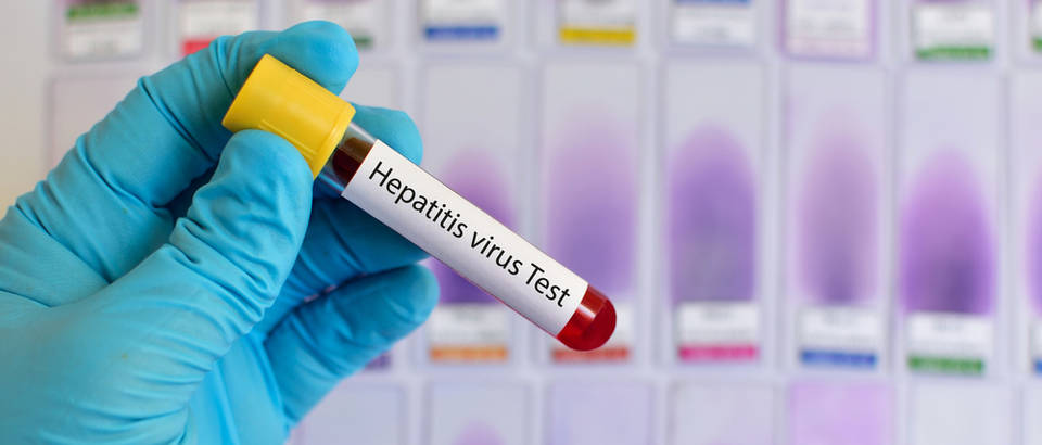 bol u zglobovima kod hepatitisa