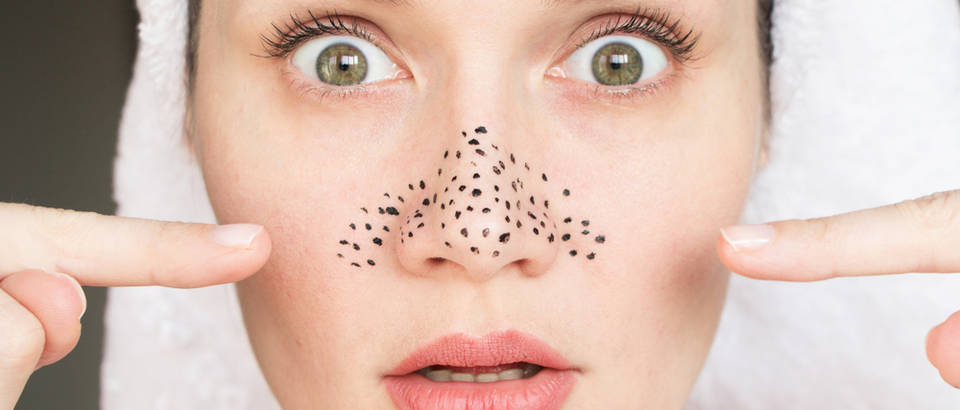 pore