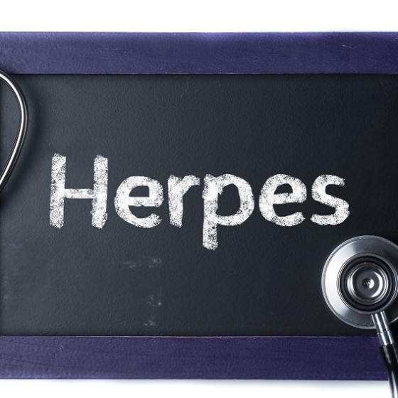 Roditelj ste male bebe i dobili ste herpes? Ovo su ključne stvari koje morate znati