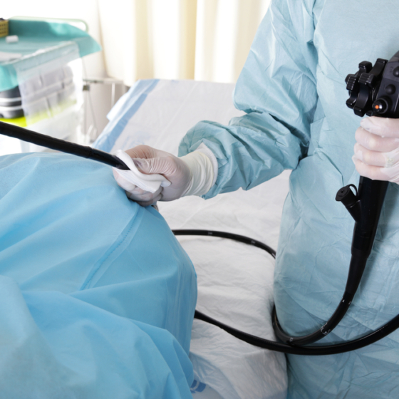 Idete na kolonoskopiju? Ovo je sve što trebate znati o pretragama, uputnici i naručivanju